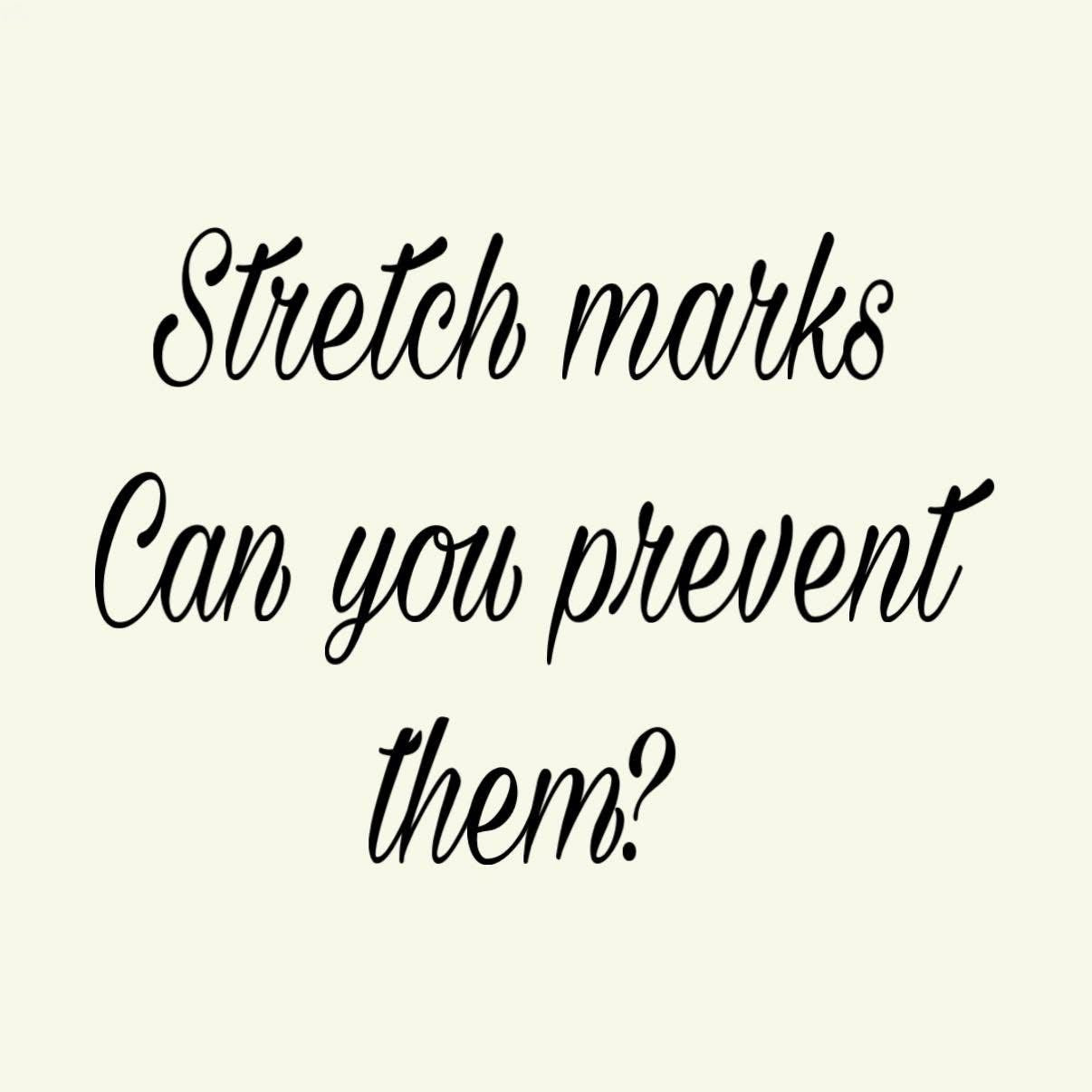 Let’s talk stretch marks